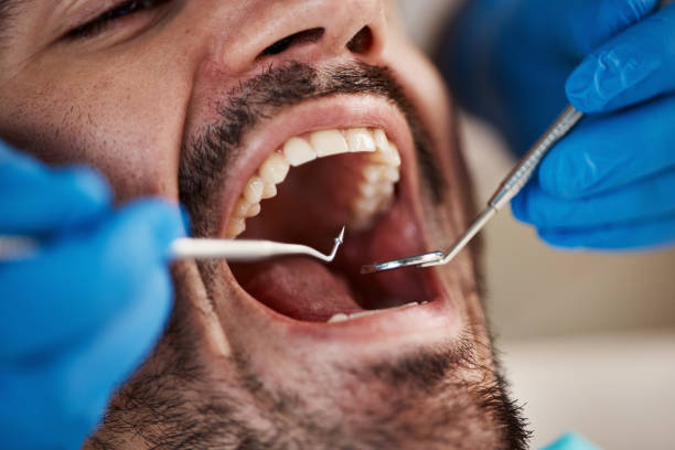 Best Emergency Dental Care for Abscessed Tooth in Fairchance, PA