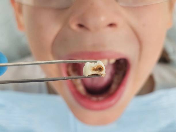 Best Broken or Cracked Tooth Emergency Dentist in Fairchance, PA